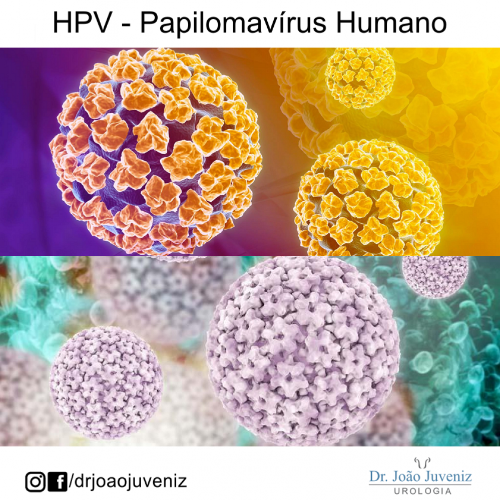 Vírus HPV - Papilomavírus Humano - Dr. João Juveniz